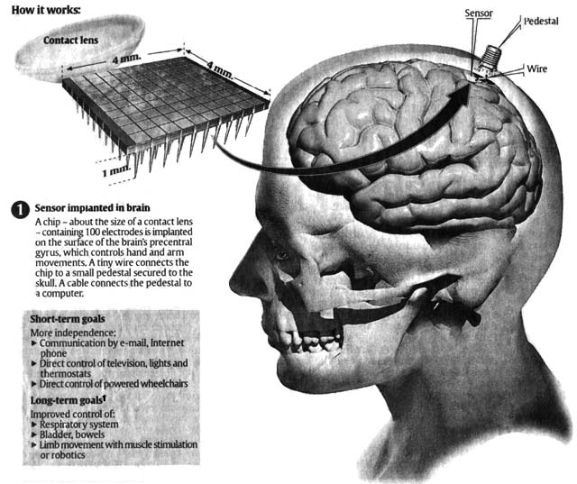 http://taboodada.files.wordpress.com/2012/09/microchip-implant-on-the-brain.jpg